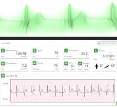Qardio, a leading innovator in healthcare technology, has unveiled its groundbreaking Livestream solution suite, which includes continuous ECG, Blood Pressure, Pulse Oximetry (SPO2), Body Temperature, Weight, and Body Position monitoring 