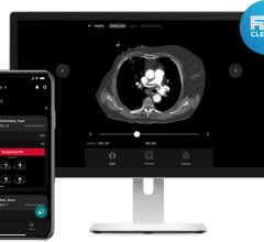 Integrated with the Rapid PE solution, Rapid RV/LV further accelerates time to triage and diagnose pulmonary embolism patients with right heart strain 