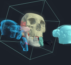 Healthcare software start-up, Realize Medical, announced today that its virtual reality (VR) software for surgical planning, Elucis, has received 510(k) clearance from the U.S. Food and Drug Administration (FDA). 