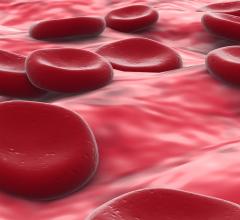Researchers Develop Reversible, Drug-Free Antiplatelet Therapy