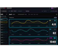 Retia Medical's Argos Infinity, cardiovascular intelligence software platform  