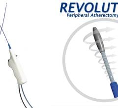 The Rex Medical Revolution rotational atherectomy system incorporates continuous aspiration and has a dual indication for atherectomy and thrombectomy.  #VICA19 #VIVA2019