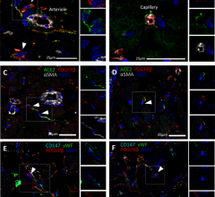 Expression of SARS-CoV-2 receptors in human cardiac PCs in situ: Immunofluorescence stainings showing PCs in the human heart. (A,B) Identification of CD31−CD34+PDGFRβ+ PCs around microvessels. CD31 recognises the vessel lumen, the CD34 labels both the luminal ECs and perivascular PCs, while PDGFRβ labels both PCs and vascular smooth muscle cells (VSMCs) in the arteriole’s tunica media. (C–F) A subset of PDGFRβ+ cardiac PCs express ACE2 (C,D) and CD147 (E,F). α-SMA labels some PCs and arterioles’ VSMCs (C,D)
