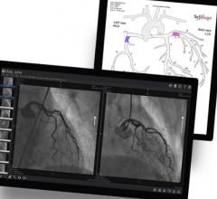 ScImage went live in March at Peak Surgery Center of Avondale, Arizona, and was developed in cooperation with the providers from multispecialty cardiovascular group Peak Heart & Vascular, which has locations in Avondale, Surprise, Ariz., and Flagstaff, Ariz. ScImage’s PICOM365 Cloud provides image review, storage and advanced structured reporting to manage the complex, measurement-centric cardiac catheterization procedures performed in the facilities.