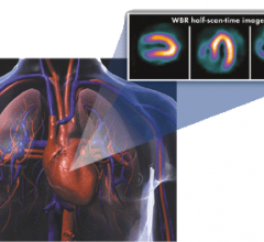 ultraspect xpress.cardiac nuclear imaging spect radiation dose 