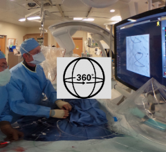 Philips Azurion Clarity IQ angiography system at the University of Colorado being used during a CTO case.
