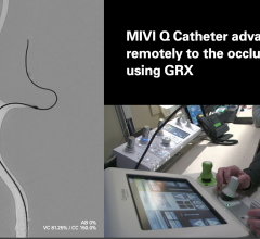 The MIVI Neuroscience Q Aspiration Catheter incorporates a novel pusher wire design on its proximal end. This feature has demonstrated in simulated use studies that the Q Catheter may be uniquely suited to allow physicians in the future to treat ischemic stroke patients remotely via a robot from a different room, a different city, or even a different country. 