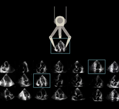 The combination of ScImage’s Cloud-centric and DiA’s AI-based cardiac ultrasound software will offer echo labs of any size a unique workflow solution 