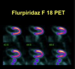 Phase III clinical trial of [18F]flurpiridaz PET diagnostic radiopharmaceutical meets co-primary endpoints for detecting Coronary Artery Disease (CAD) 