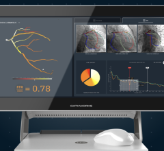 The CathWorks FFRangio System to Be Featured in Multiple Live Cases and Clinical Presentations at TCT 2022 