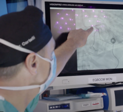 The new ECHO lab enables cardiac teams to use ultrasound (or echocardiography) to assess the size and efficiency of heart chambers. Stress tests, coronary CTAs, and cardiac MRIs are also interpreted there. 