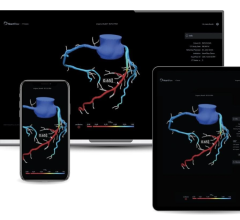 HeartFlow is the first and only company to provide non-invasive anatomy, physiology, and plaque information based on coronary computed tomography angiography (CCTA) 