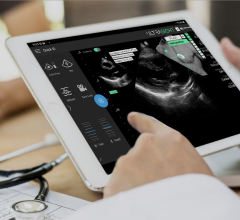 Today, UltraSight announced the findings from a landmark pivotal study that confirms its AI guidance technology enables novice ultrasound users to acquire high-quality diagnostic images of the 10 standard cardiac views.