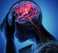 LACI-2 shows reduction in cognitive decline after lacunar stroke