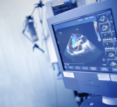 The Midwest company will begin offering EchoSolv, an artificial intelligence clinical decision support platform designed to help detect severe aortic stenosis, to providers throughout the country. 