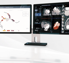 HeartFlow announced that new data on HeartFlow Plaque Analysis and its RoadMap Analysis will be presented at the 2023 Society of Cardiovascular Computed Tomography (SCCT) Annual Scientific Meeting in Boston, MA. 