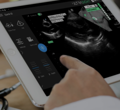 New AI guidance software will allow more medical professionals to conduct cardiac ultrasound in multiple care settings expanding patient access to cardiac imaging