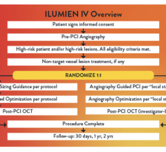 Data from the landmark ILUMIEN IV trial, the first randomized imaging trial with global representation, has the potential to change clinical practice related to stent placement 