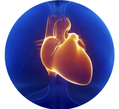 Beilinson Hospital in Israel used Nanox.AI’s HealthCCSng solution to conduct study on routine chest CT scans to assess impact of AI-based coronary artery calcium (CAC) measurements 