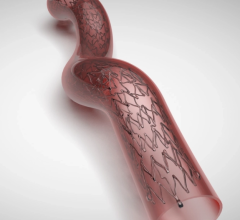 Clinical trial data released during VIVA 2023 Conference included results from a study involving the Veryan Medical BioMimics 3D Vascular Stent System.  
