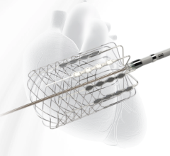 Cardionomic, Inc., a Minneapolis medical device company, is pleased to announce the completion of enrollment in both their STIM-ADHF and STOP-ADHF pilot studies.
