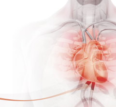 The companies will jointly support a series of educational forums among clinicians beginning later this year highlighting the significant new scientific breakthroughs that are radically transforming the traditional approach to heart disease prevention and prediction 