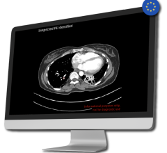 Medical imaging AI company receives approval for algorithms enabling incidental detection of pulmonary embolism and automatic assessment of stroke severity