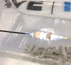 The Shockwave intravascular lithotripsy system produces a flash of light as it releases a sonic shockwave, as seen here as it is about to shatter a gypsum bead during a TCT 2019 demonstration at the vendor's booth. The technology combines a miniaturized lithotripsy system with a low-pressure balloon catheter to expand peripheral or coronary arteries without causing vessel trauma. Photo by Dave Fornell