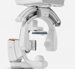 he University of Wisconsin (UW) Health’s University Hospital in Madison, Wis., recently became the first facility in the United States to install the Artis icono biplane angiography imaging system from Siemens Healthineers.