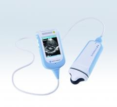 ultrasound systems rsna 2013 konica minolta