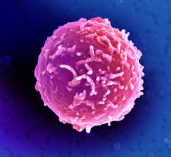 Capricor ALLSTAR Phase I Clinical Trial TCT 2014 Stem Cells Myocardial Regenerat