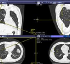 Imaging cardiac PACS mckesson methodist le bonheur MLH data cardiovascular