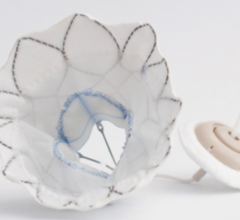Tendyne Transcatheter Mitral Valve Replacement Device Demonstrates Positive 30-Day Outcomes
