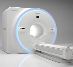 Toshiba Vantage Galan 3T XGO Edition MRI Features New Advanced Gradient