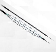 Sterling SL PTA Balloon Dilatation Catheter | DAIC