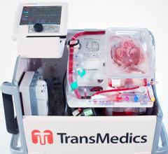 The Transmedics Organ Care System (OCS) Heart, or “Heart in a Box,” enables transplant surgeons to travel to much farther destinations to procure transplant hearts by acting as a miniature intensive care unit that keeps the heart alive.