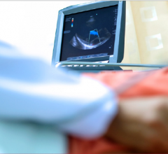 Artificial intelligence is becoming best practice to support clinical decisions and help standardize echocardiography analysis for practices. AI, trained on millions of outcome-based data, can provide automation for operators to obtain highly accurate and precise measurements, to better detect and predict cardiovascular disease.