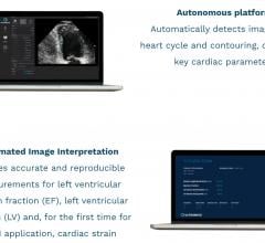 EchoGo uses AI to calculate cardiac ultrasound left ventricular ejection fraction (EF), the most frequently used measurement of heart function, left ventricular volumes (LV) and, for the first time for an AI application, automated cardiac strain.