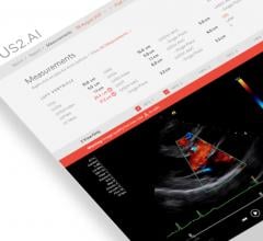 Us2.ai has received U.S. Food and Drug Administration (FDA) clearance for its artificial intelligence (AI) Us2.v1 software, a completely automated decision support tool for echocardiography.