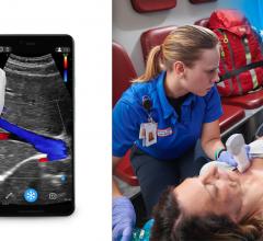 Vscan Air, a pocket-sized ultrasound from GE Healthcare, enters the market as one of the smallest and lightweight handheld devices without compromising crystal clear image quality and secure data sharing. The vScan is a point of care ultrasound (POCUS).
