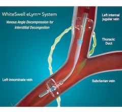 WhiteSwell Announces Trial Results Related to the DELTA-HF Study in Acute Decompensated Heart Failure