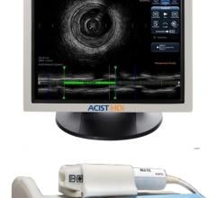 Acist, high-definition intravascular ultrasound system, HD-IVUS