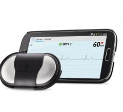 patient monitors ecg software mobile devices alivecore heart monitor