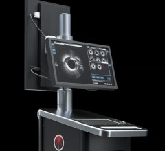 Avinger, Lightbox L250 imaging console, upgrade, Lumivascular platform, OCT, optical coherence tomography