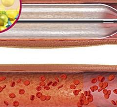 Primus Drug-Eluting Balloon Balloon Catheters Peripheral Artery Disease devices
