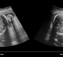 ContextVision, US PLUSView ultrasound enhancement software, iOS