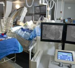 Corindus Announces First Robotic-Assisted PCI Procedures Performed in Asia Using CorPath GRX System