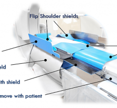 The Egg Medical EggNest cath lab patient table is designed with passive protection designed to drastically reduce scatter radiation exposure for the entire cath lab team without disruption to workflow. 