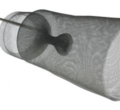 The Emboliner Embolic Protection Catheteris designed to capture debris released from the valve and vessel walls during transcatheter aortic valve replacement (TAVR) procedures. 
