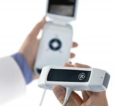 GE Healthcare Vscan Pocket-sized Ultrasound System With Dual Probe